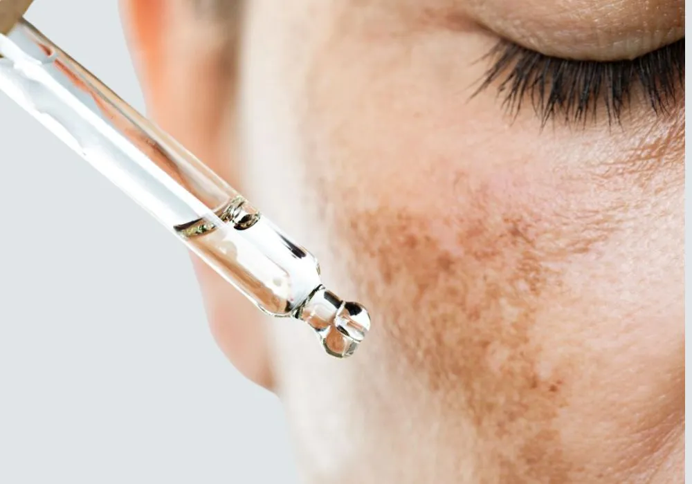 Acne & Acne Scar Treatment